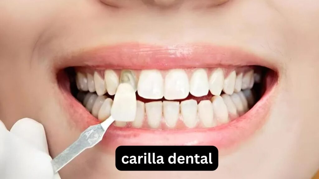 Carilla dental